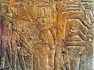 الختان بمصر القديمة